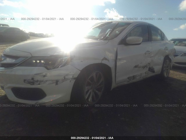 19UDE2F31GA012986  acura ilx 2016 IMG 1