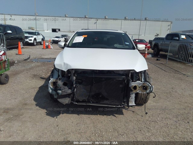 19UDE2F73GA006691  acura ilx 2016 IMG 5