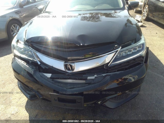 19UDE2F73GA020140  acura ilx 2016 IMG 5