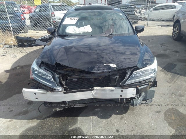 19UDE2F89GA007014  acura ilx 2016 IMG 5