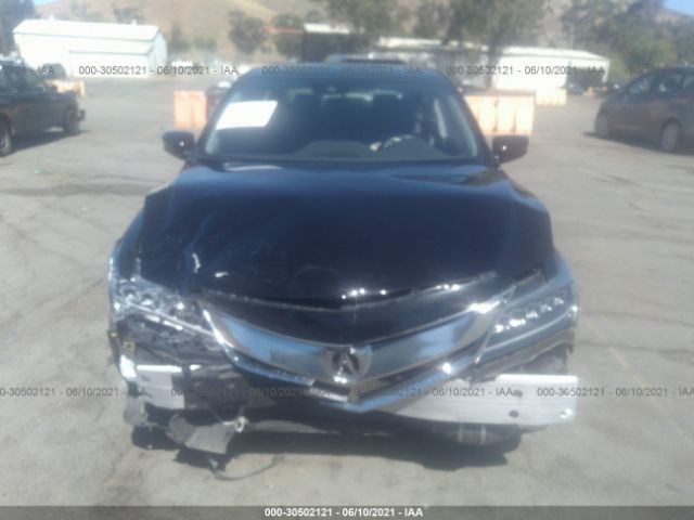 19UDE2F31JA001400  acura ilx 2018 IMG 5