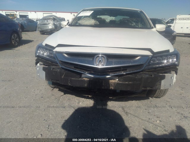 19UDE2F43JA000001  acura ilx 2018 IMG 5