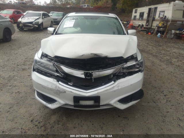 19UDE2F46JA005614  acura ilx 2018 IMG 5