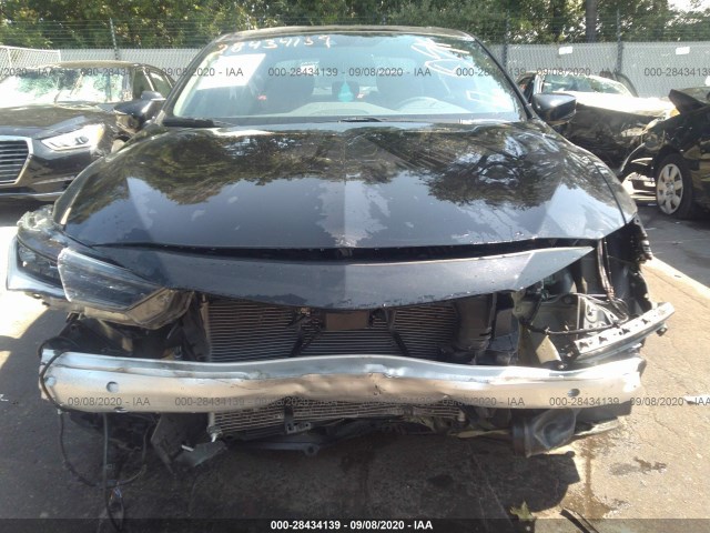 19UDE2F89KA008737  acura ilx 2019 IMG 5