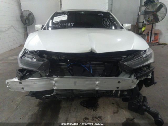 19UDE2F81MA010887  acura ilx 2021 IMG 5