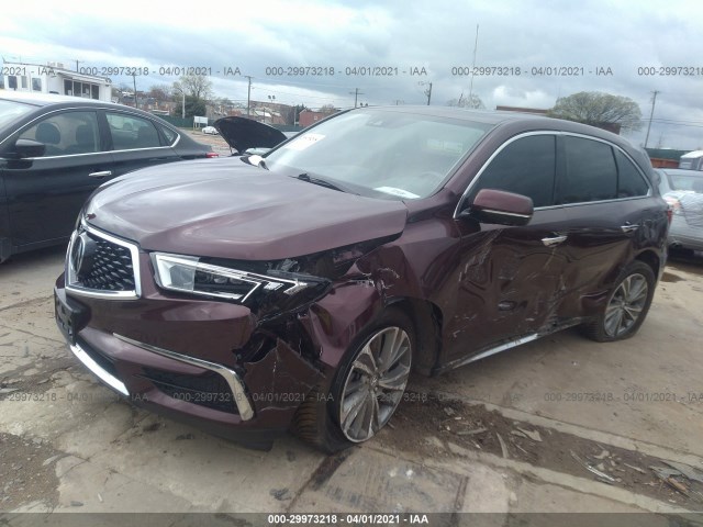 5FRYD4H51HB031560  acura mdx 2017 IMG 1