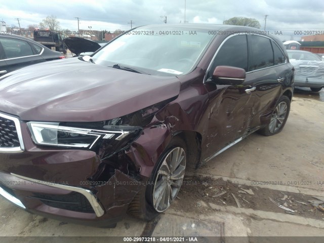 5FRYD4H51HB031560  acura mdx 2017 IMG 5