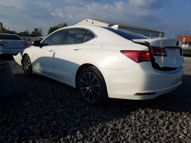 19UUB3F56FA801942  acura  2015 IMG 2