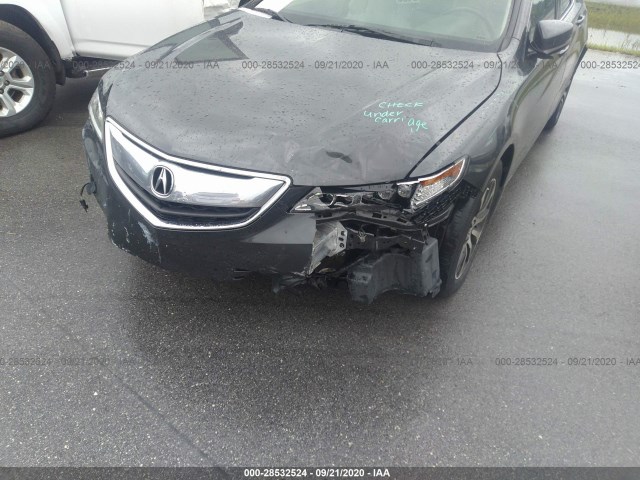 19UUB1F34FA025751  acura tlx 2015 IMG 5