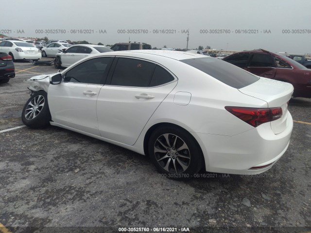 19UUB1F34GA001970  acura tlx 2016 IMG 2