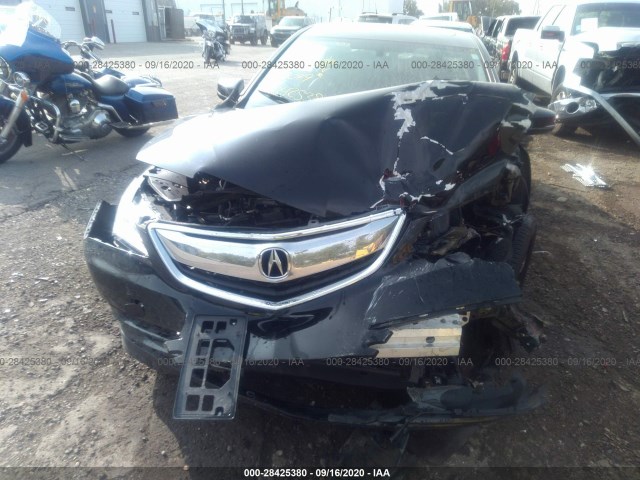 19UUB1F39GA003049  acura tlx 2015 IMG 5