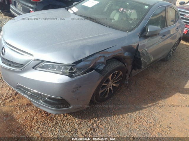 19UUB1F56FA009519  acura tlx 2015 IMG 5