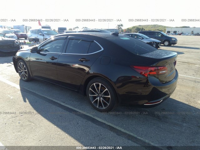 19UUB2F3XFA020446  acura tlx 2015 IMG 2