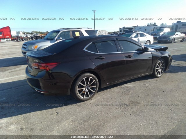 19UUB2F3XFA020446  acura tlx 2015 IMG 3