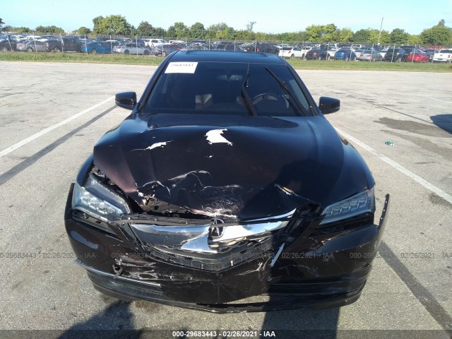 19UUB2F3XFA020446  acura tlx 2015 IMG 5