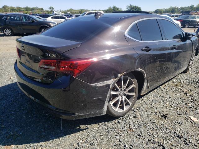 19UUB2F5XFA016687  acura tlx 2015 IMG 3