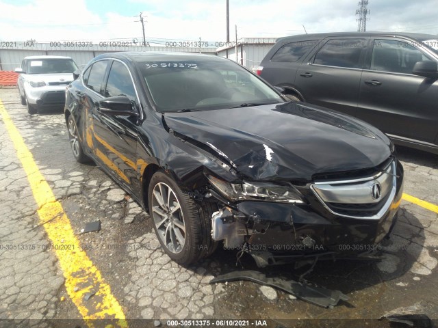 19UUB2F78FA025762  acura tlx 2015 IMG 0