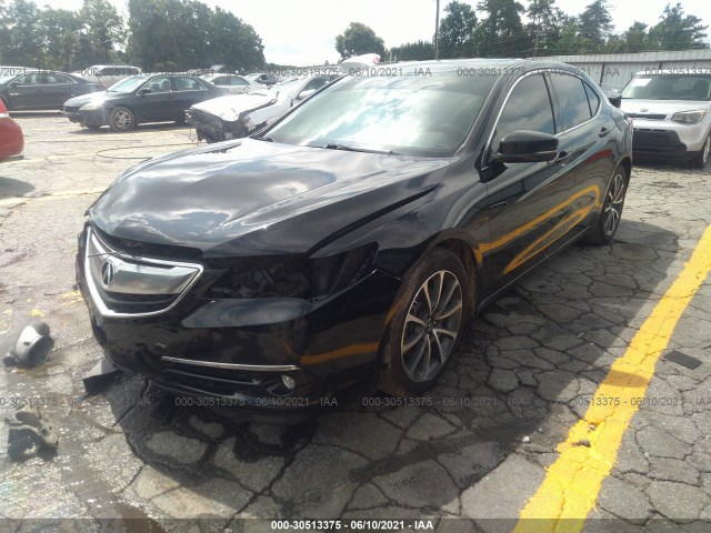 19UUB2F78FA025762  acura tlx 2015 IMG 1