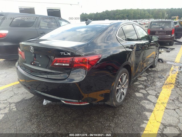 19UUB2F78FA025762  acura tlx 2015 IMG 3