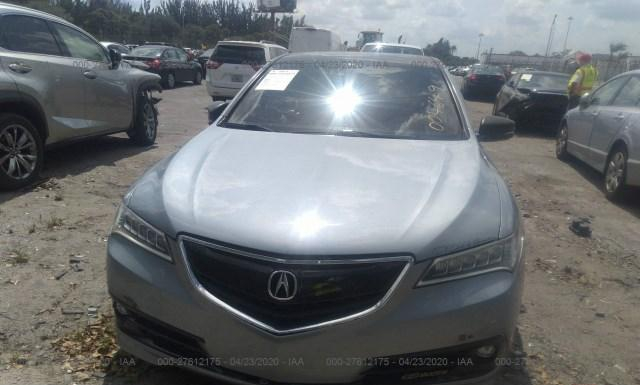 19UUB3F50FA004649  acura tlx 2015 IMG 5