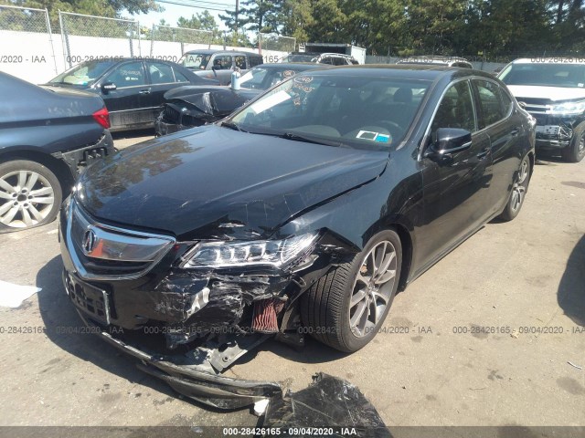 19UUB3F51FA008855  acura tlx 2015 IMG 1