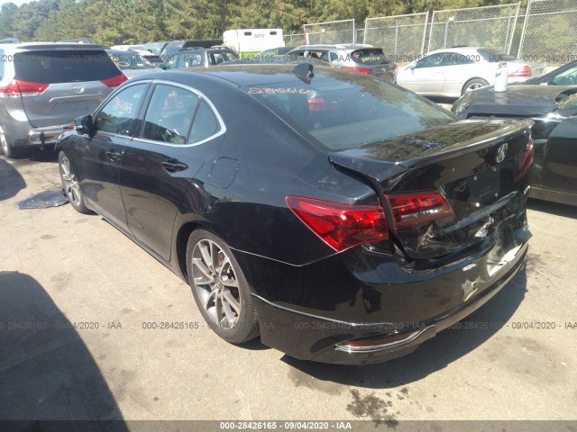 19UUB3F51FA008855  acura tlx 2015 IMG 2