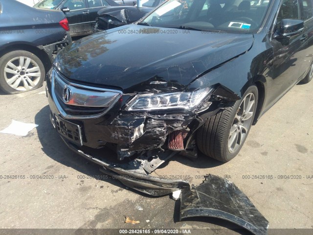 19UUB3F51FA008855  acura tlx 2015 IMG 5