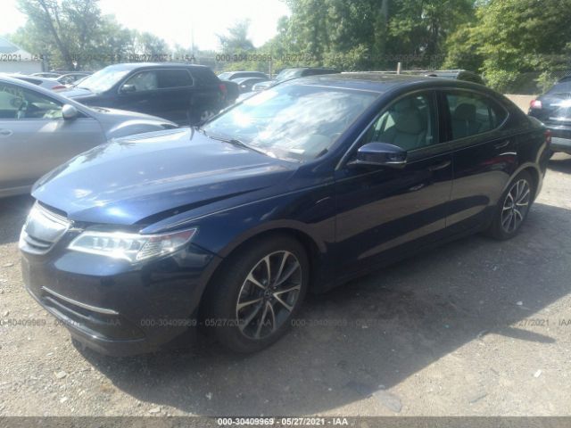 19UUB3F53FA008078  acura tlx 2015 IMG 1