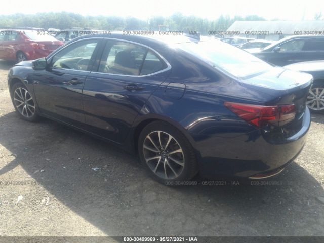 19UUB3F53FA008078  acura tlx 2015 IMG 2