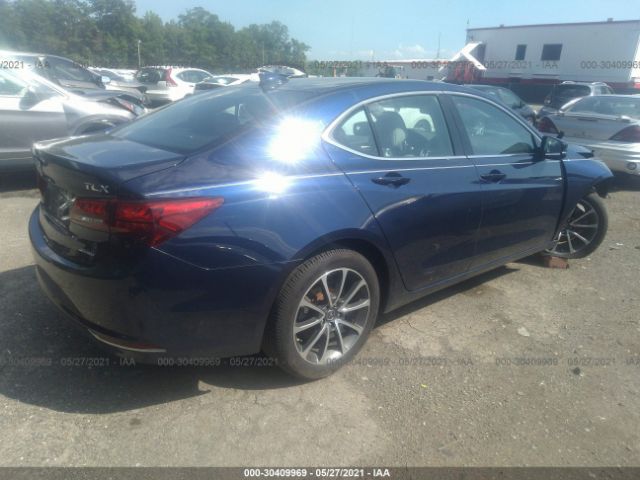 19UUB3F53FA008078  acura tlx 2015 IMG 3