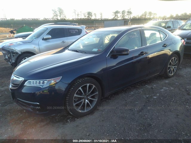 19UUB3F50GA004538  acura tlx 2016 IMG 1