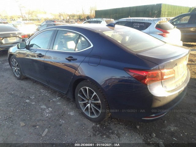 19UUB3F50GA004538  acura tlx 2016 IMG 2