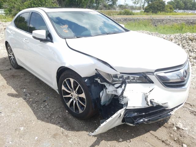 19UUB1F39HA001139  acura tlx 2017 IMG 0