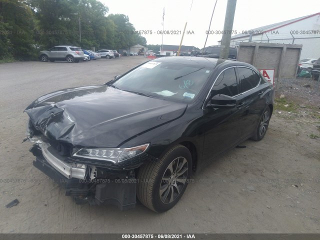 19UUB1F56HA009555  acura tlx 2017 IMG 1