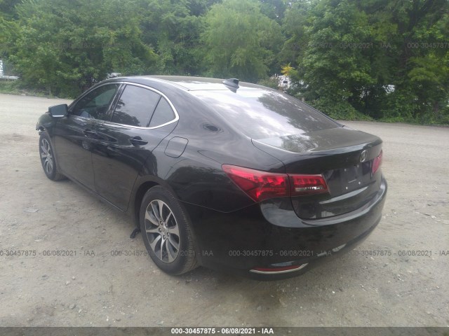 19UUB1F56HA009555  acura tlx 2017 IMG 2