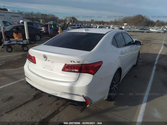 19UUB2F31JA008145  acura tlx 2018 IMG 3