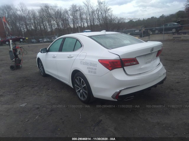 19UUB2F36JA012143  acura tlx 2018 IMG 2