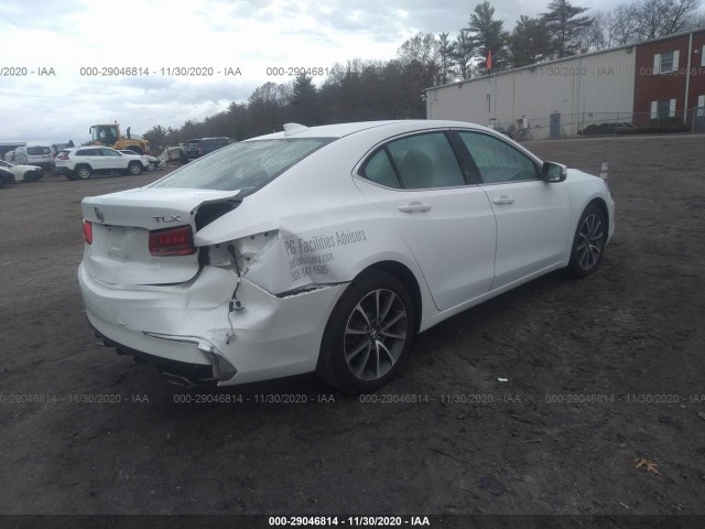 19UUB2F36JA012143  acura tlx 2018 IMG 3