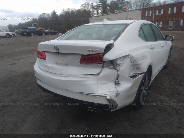 19UUB2F36JA012143  acura tlx 2018 IMG 5