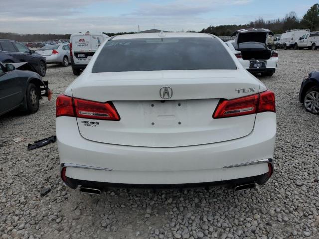 19UUB2F51JA002279  acura  2018 IMG 5