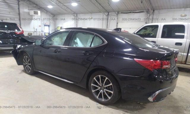 19UUB2F59JA001834  acura tlx 2018 IMG 2