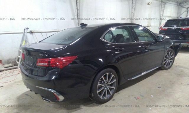 19UUB2F59JA001834  acura tlx 2018 IMG 3