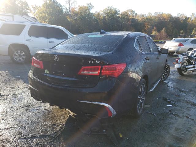 19UUB2F59JA012736  acura  2018 IMG 3