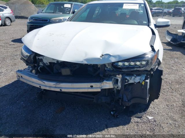 19UUB2F69JA009456  acura tlx 2018 IMG 5