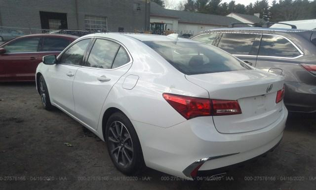 19UUB3F30JA004397  acura tlx 2017 IMG 2