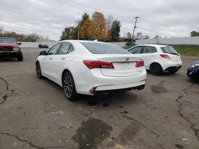 19UUB3F35JA004153  acura tlx 2018 IMG 2