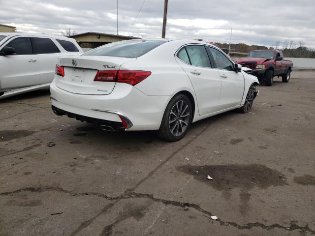 19UUB3F35JA004153  acura tlx 2018 IMG 3