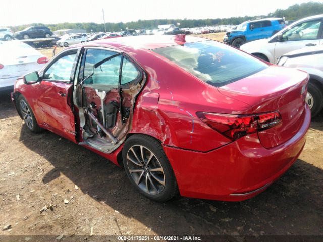 19UUB3F79HA003455  acura tlx 2017 IMG 2