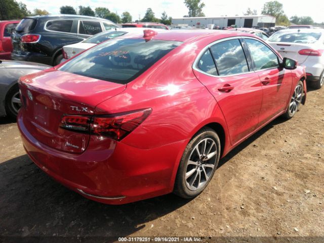 19UUB3F79HA003455  acura tlx 2017 IMG 3