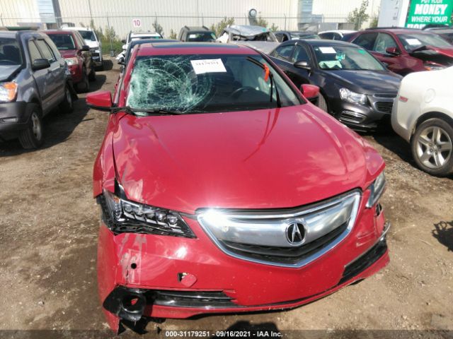 19UUB3F79HA003455  acura tlx 2017 IMG 5